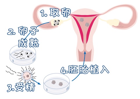 液氮库